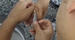 Osmaniye’de bir kişinin parmağında sıkışan yüzük, itfaiye ekiplerince kesilerek çıkarıldı