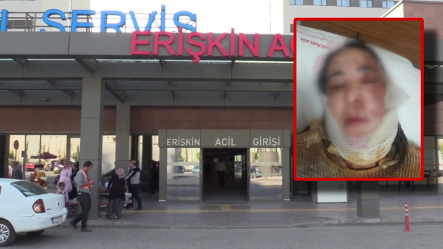 ADANA’DA ÜVEY ANNESİNİN ÜZERİNE KEZZAP ATARAK YARALAYAN GENÇ ARANIYOR…