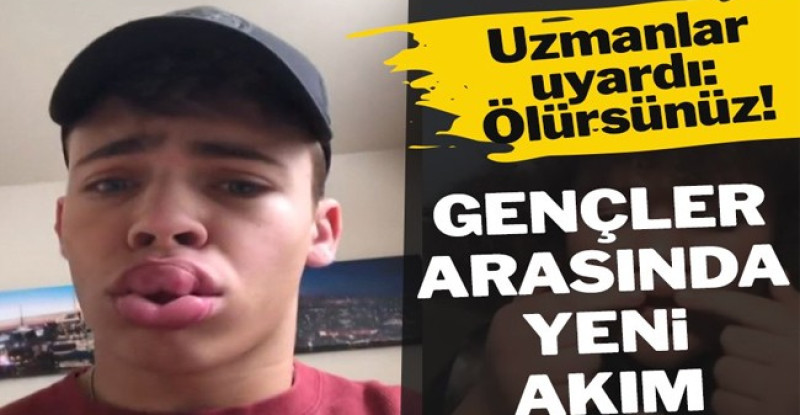 Gençlerin tehlikeli ‘evde estetik’ akımı