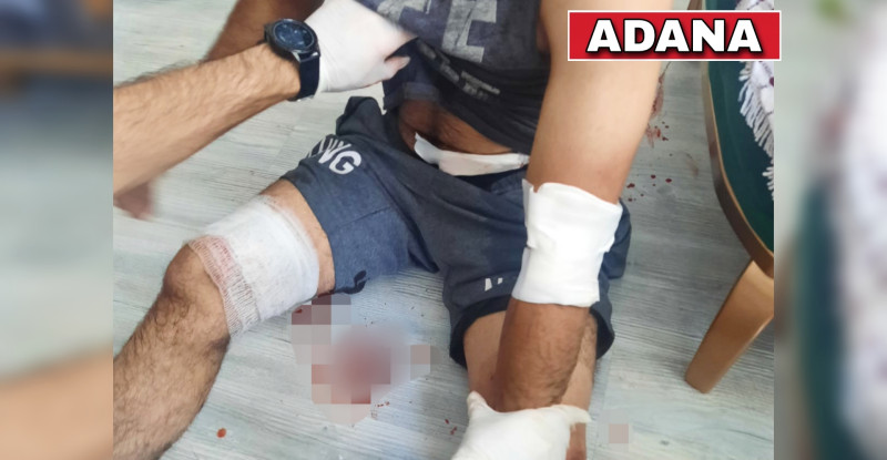 ADANA’DA BİR KADIN TARTIŞTIĞI EŞİNİ BIÇAKLA YARALADI…