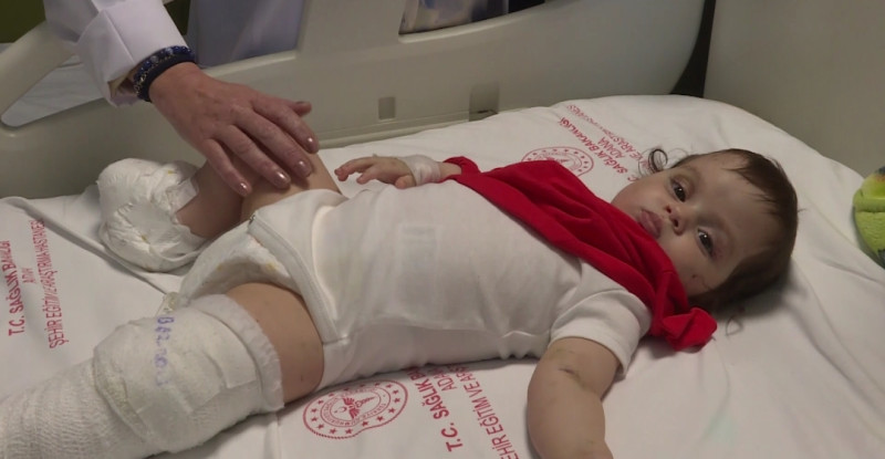 HATAY’DA DEPREMİN ETKİSİYLE 5’İNCİ KATTAN DÜŞEN BİRCE BEBEK İYİLEŞİYOR