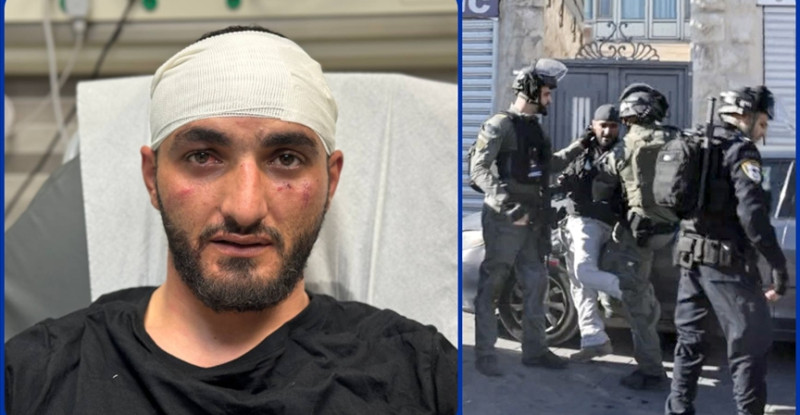 İSRAİL GÜÇLERİ, AA FOTO MUHABİRİNİ DOĞU KUDÜS’TE GÖREVİ SIRASINDA DARPETTİ