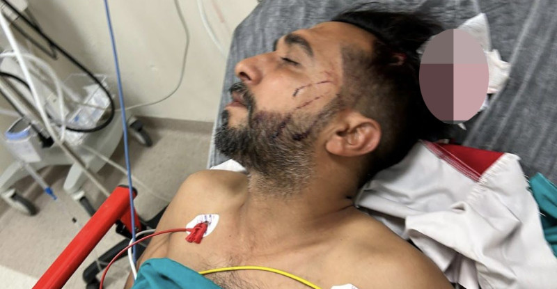 ADANA’DA DÖNER USTASI, İŞ YERİNDE BAŞINA İSABET EDEN YORGUN MERMİYLE YARALANDI