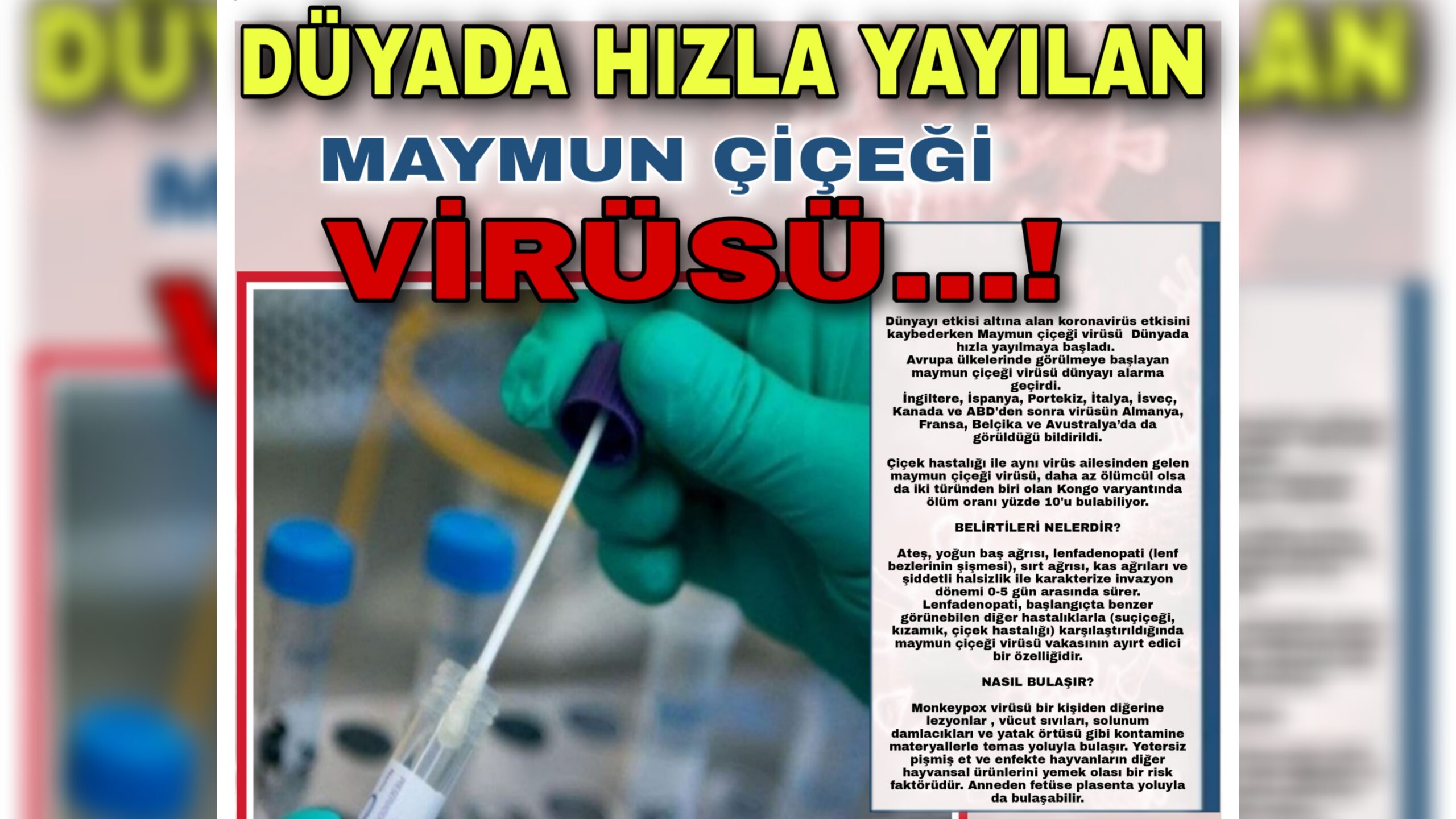 DÜYADA HIZLA YAYILAN MAYMUN ÇİÇEĞİ VİRÜSÜ…!