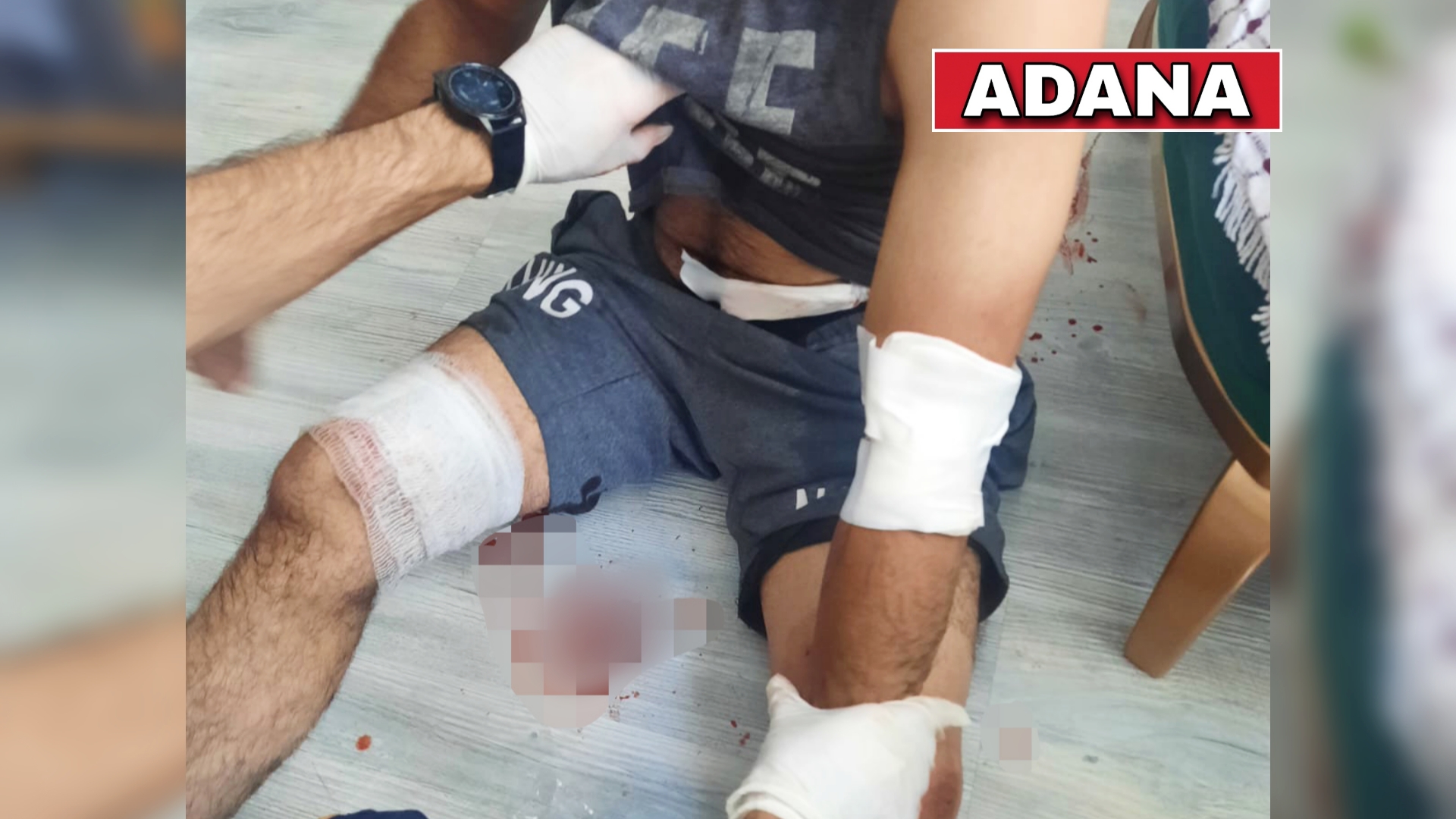 ADANA’DA BİR KADIN TARTIŞTIĞI EŞİNİ BIÇAKLA YARALADI…